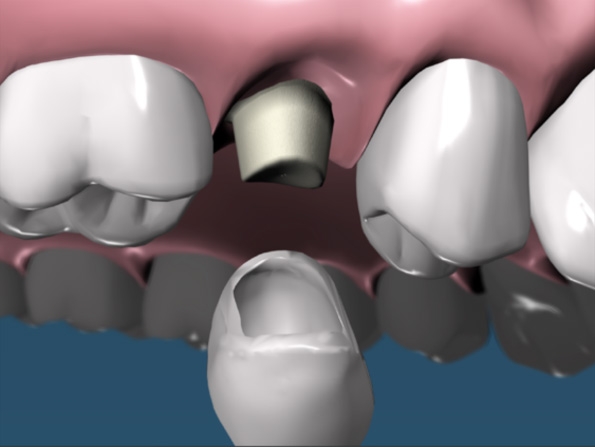 protesi - odontoiatrica urciuolo