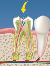 endodonzia - odontoiatrica urciuolo