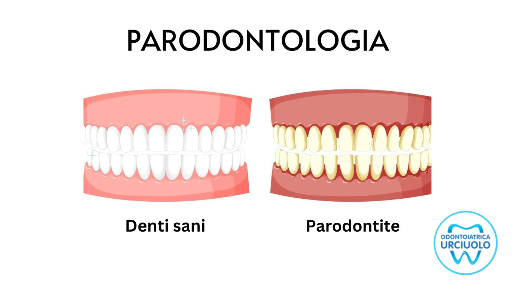 parodontologia